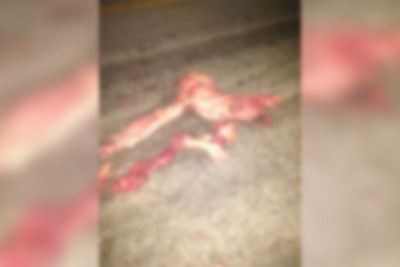 Bakı-Qazax yolunda avtomobilin vurduğu piyada tanınmaz hala düşüb
