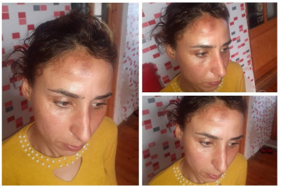 Türkan qəsəbə sakini sərnişin avtobusunda döyülüb