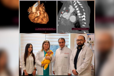 Bakı klinikasında 9 günlük körpə ürəkdən əməliyyat olunub
