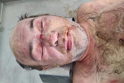 Mərdəkanda naməlum kişi meyiti tapılıb - FOTO