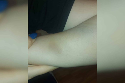 Bakıda zorla qaçırılan qız əri və qayınanasından daim şiddət görüb - FOTO