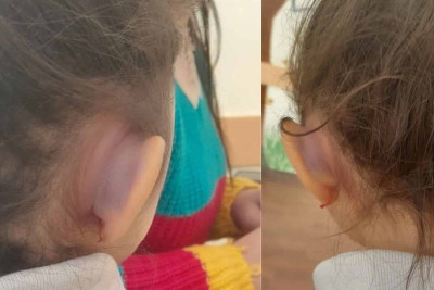 Abşeron rayonunda 7 yaşlı qız işgəncəyə məruz qalıb