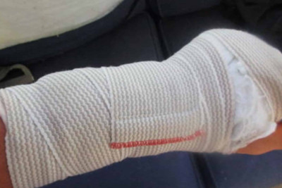 Bakıda avtoqəza zamanı sürücünün əlləri sınıb