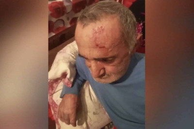 Bakının qəsəbəsində gənc oğlan atasını şiddətlə döyüb