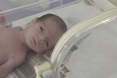 Respublika Perinatal Mərkəzində 845 qramlıq körpə dünyaya gəlib