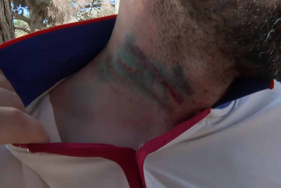 Ramanada 41 yaşlı kişi arvadı tərəfindən döyüldüyünü iddia edir