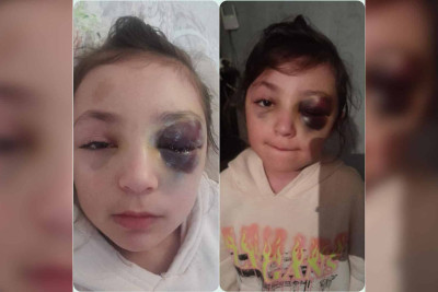Ramanada ikinci sinif şagirdi gözündən ağır zədə alıb