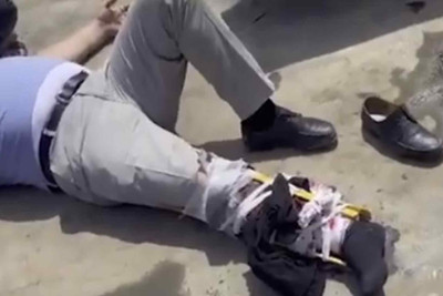 Bakıda 63 yaşlı kişi damdan düşürülərək xilas olunub – VİDEO