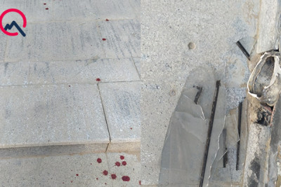 Baxımsız qalan şüşə qırıqları uşağın xəsarət almasına səbəb olub