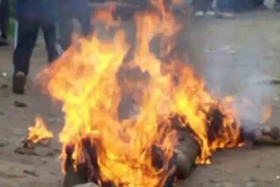 Zirədə kişi ocağa yıxılaraq yanıb