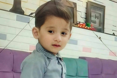 Bakıda 5 yaşlı uşaq stomatoloji əməliyyatdan sonra dünyasını dəyişib