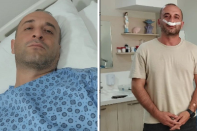 Tanınmış aktyor əməliyyat olundu