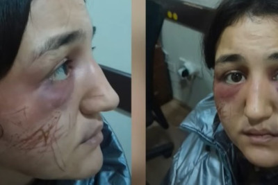 Paytaxtda DƏHŞƏT: 24 yaşlı qadın amansızca döyülüb evdən qaçdı - FOTO/VİDEO