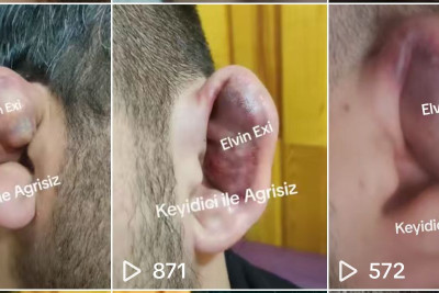 Bakıda qulaq sındırırlar! Özü də pulla - VİDEO