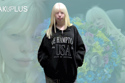 15 yaşlı “fosfor adam”: “Gözlərimiz titrəyir, bizə qəribə baxırlar”