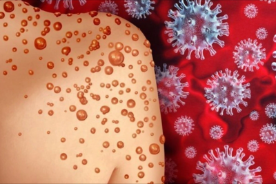 Meymunçiçəyinin əsas əlamətləri və qorunma yolları - RƏSMİ