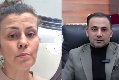 Bakıda qadın bud əməliyyatına girdi, burnunu KƏSDİLƏR 