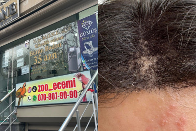 Gözəlləşməyə getdi, başını ütdülər - ŞİKAYƏT + FOTO