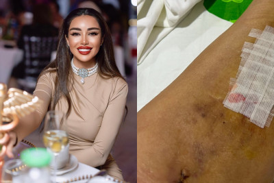 Kosmetoloqun 10 il davam edən zülmü - İDDİA + VİDEO 