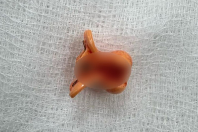 2 yaşlı uşaq saç sancağı uddu - FOTO 