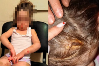 Övladına işgəncə verən ana saxlanılıb, cinayət işi başlanılıb- YENİLƏNİB