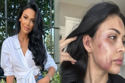 Tanınmış modeli döyməkdə təqsirləndirilənə hökm oxundu