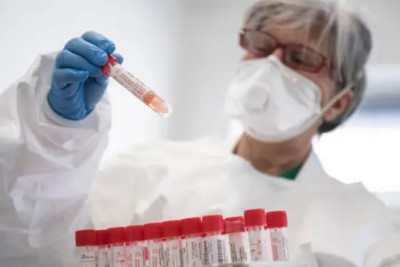 “Yeni koronavirusa yoluxma hallarına rast gəlinir” - NAZİRLİYİN MÜTƏXƏSSİSİNDƏN ÖZƏL AÇIQLAMA