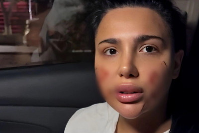 Bakıda qadına hücum: Sabiq vəzifəli şəxsin nəvəsi SAXLANILDI