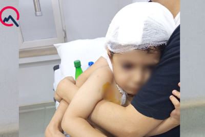 Masazırda 2 yaşlı uşağı it dişlədi