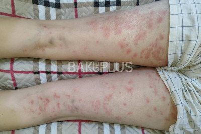 Nəbabət Bağında dəhşətli vəziyyət – Uşaqlar ağır durumda + İDDİA/FOTO
