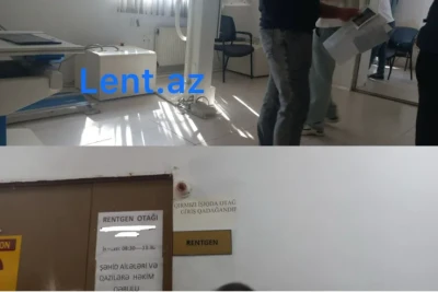 Binə xəstəxanasında hərc-mərclik - Rentgen otağına 5 nəfər daxil olur