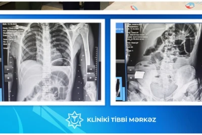 17 yaşı var, taxta udub