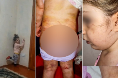 Bakıda ananın 4 yaşlı qızına verdiyi işgəncələr: Bədəni yandırılıb, kəmərlə döyülüb