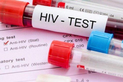 Azərbaycanda İİV-ə yoluxanların sayı açıqlandı