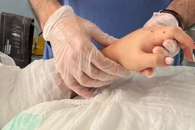 Bakıda qızın qopmuş qolu yerinə bərpa olundu
